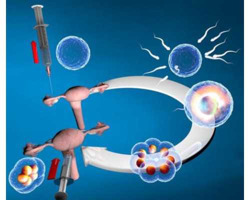 广州解放军总医院试管婴儿技术探讨与成功经验分享