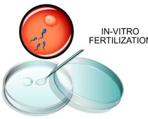 成都西囡医院与台湾供卵医院的辅助生殖服务比较