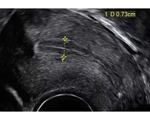 贺州市人民医院:三甲资质与辅助生殖服务解析